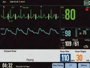 Дефибриллятор-монитор Beneheart D6 кардиостимуляция