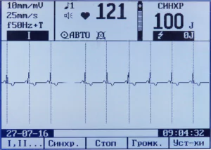 ДКИ-Н-10 кардиоверсия