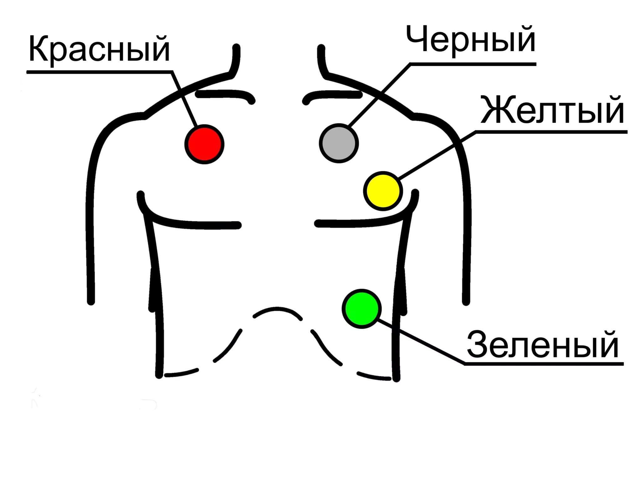 Установка холтера схема наложения 10 электродов